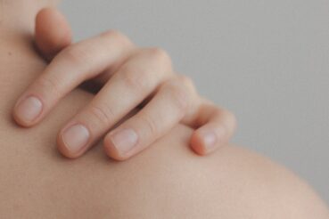 skin tag and milia seed