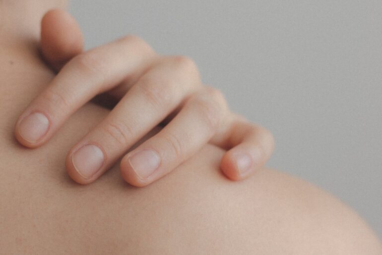 skin tag and milia seed